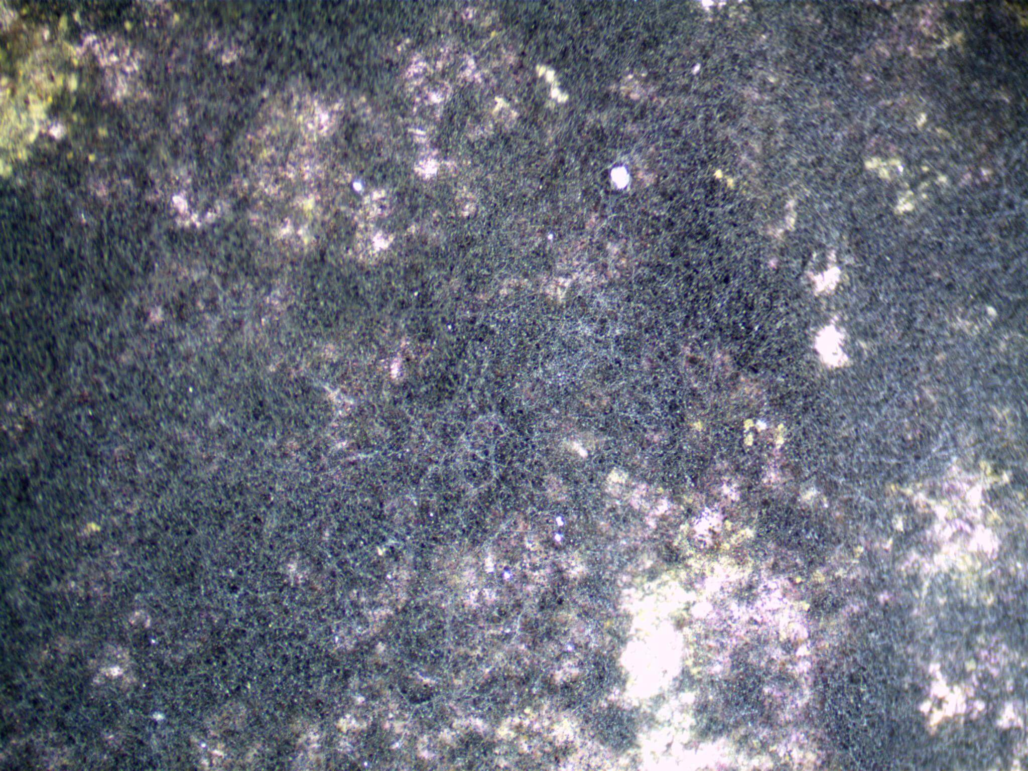 Observation au microscope des structures reproductrices de la moisissure Stachybotrys.